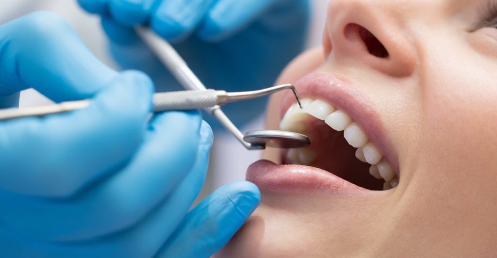 Лікування карієсу зубів